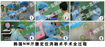 手术全过程.jpg