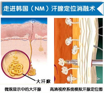 技术原理示意图